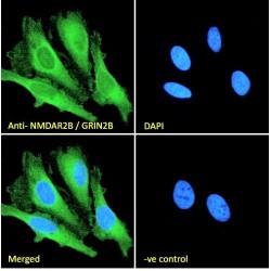 Glutamate Receptor Ionotropic, NMDA 2B (GRIN2B) Antibody