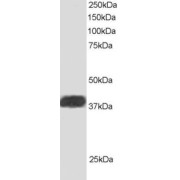 abx430786 staining (1 µg/ml) of Human Heart lysate (RIPA buffer, 30µg total protein per lane). Primary incubated for 1 hour. Detected by western blot using chemiluminescence.