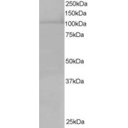 abx430787 staining (0.5 µg/ml) of Hela lysate (RIPA buffer, 35 µg total protein per lane). Primary incubated for 1 hour. Detected by chemiluminescence.