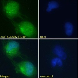 Amyotrophic Lateral Sclerosis 2 Chromosomal Region Candidate Gene 2 Protein (ALS2CR2) Antibody