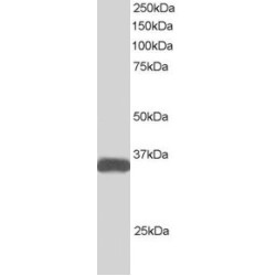 Amyotrophic Lateral Sclerosis 2 Chromosomal Region Candidate Gene 2 Protein (ALS2CR2) Antibody