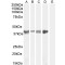 Asporin (ASPN) Antibody