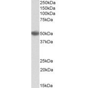 Western blot analysis of Human Bone Marrow lysate (35 µg protein in RIPA buffer) using DC-SIGN Antibody (0.3 µg/ml, 1 hour).