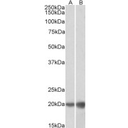abx430799 (0.1 µg/ml) staining of HEK293 (A) and HeLa (B) lysates (35 µg protein in RIPA buffer). Detected by chemiluminescence.