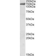 abx430801 (0.3 µg/ml) staining of Human cerebellum lysate (35 µg protein in RIPA buffer). Detected by chemiluminescence.