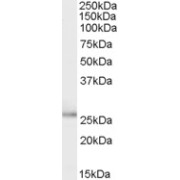 abx430820 (0.1 µg/ml) staining of Human Breast cancer lysate (35 µg protein in RIPA buffer). Primary incubation was 1 hour. Detected by chemiluminescence.