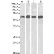 abx430824 (0.1 µg/ml) staining of Human Kidney (A) and Liver (B) and Mouse Kidney (C) and Liver (D) lysates (35 µg protein in RIPA buffer). Primary incubation was 1 hour. Detected by chemiluminescence.