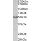 M1 mAChR Antibody