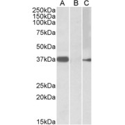 HEK293 lysate (10 µg protein in RIPA buffer) overexpressing Human MYF6 with MYC tag probed with abx430830 (0.5 µg/ml) in Lane A and probed with anti-MYC Tag (1/1000) in lane C. Mock-transfected HEK293 probed with abx430830 (0.5mg/ml) in Lane B. Primary incubations were for 1 hour. Detected by chemiluminescence.