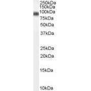 abx430833 (0.1 µg/ml) staining of Human Spleen lysate (35 µg protein in RIPA buffer). Detected by chemiluminescence.