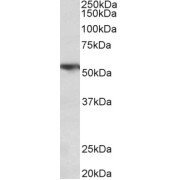 abx430836 (0.3 µg/ml) staining of Human Lung lysate (35 µg protein in RIPA buffer). Primary incubation was 1 hour. Detected by chemiluminescence.