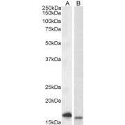 abx430846 (0.1 µg/ml) staining of Jurkat (A) and (0.3 µg/ml) MOLT4 (B) cell lysate (35 µg protein in RIPA buffer). Primary incubation was 1 hour. Detected by chemiluminescence.