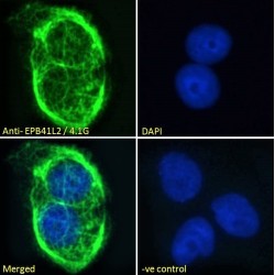 Erythrocyte Membrane Protein Band 4.1 Like 2 (EPB41L2) Antibody