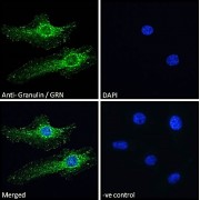 Immunofluorescence analysis of paraformaldehyde fixed HeLa cells, permeabilized with 0.15% Triton. Primary incubation 1hr (10 µg/ml) followed by Alexa Fluor 488 secondary antibody (2 µg/ml), showing ER/vesicle staining. The nuclear stain is DAPI (blue). Negative control: Unimmunized goat IgG (10 µg/ml) followed by Alexa Fluor 488 secondary antibody (2 µg/ml).