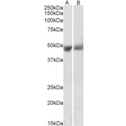 abx430860 (0.3 µg/ml) staining of Human Albumin-depleted Plasma (A) and Serum (B) lysates (35 µg protein in RIPA buffer). Primary incubation was 1 hour. Detected by chemiluminescence.