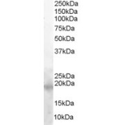 abx430862 (0.01 µg/ml) staining of Molt-4 lysate (35 µg protein in RIPA buffer). Primary incubation was 1 hour. Detected by chemiluminescence.