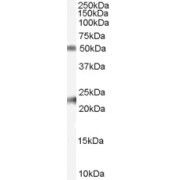 abx430871 (0.1 µg/ml) staining of Human Ovary lysate (35 µg protein in RIPA buffer). Primary incubation was 1 hour. Detected by chemiluminescence.