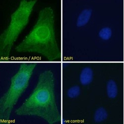 Clusterin (CLU) Antibody