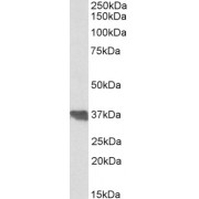 abx430877 (0.1 µg/ml) staining of Human Colon lysate (35 µg protein in RIPA buffer). Detected by chemiluminescence.