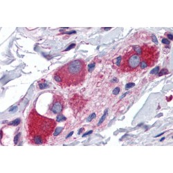 GTRAP3-18 Antibody