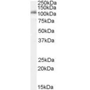 abx430884 (0.1 µg/ml) staining of K562 cell lysate (35 µg protein in RIPA buffer). Detected by chemiluminescence.