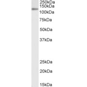 Western blot analysis of K562 cell lysate (35 µg protein in RIPA buffer) using Insulysin Antibody  (0.3 µg/ml, 1 hour). Detected by chemiluminescence, using streptavidin-HRP and using NAP blocker as a substitute for skimmed milk.