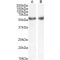 LXR alpha Antibody