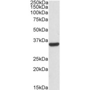 abx430902 (0.03 µg/ml) staining of HepG2 lysates (35 µg protein in RIPA buffer). Detected by chemiluminescence.