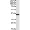 Calponin 2 (CNN2) Antibody