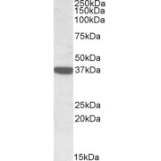 abx430903 (0.3 µg/ml) staining of Human Duodenum lysate (35 µg protein in RIPA buffer). Detected by chemiluminescence.