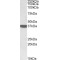 Calponin 3 (CNN3) Antibody