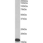 abx430906 (0.03 µg/ml) staining of Human Albumin-depleted Serum (35 µg protein in RIPA buffer). Primary incubation was 1 hour. Detected by chemiluminescence.