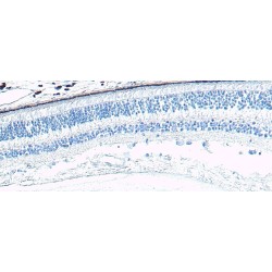 Arrestin-C (ARR3) Antibody