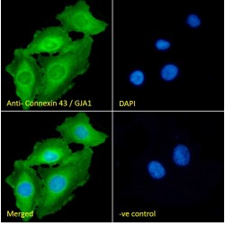 Gap Junction Alpha-1 Protein / CX43 (GJA1) Antibody