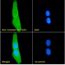 Gap Junction Alpha-1 Protein / CX43 (GJA1) Antibody