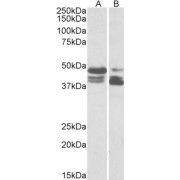 abx430929 (0.03 µg/ml) staining of HeLa (lane 1) and Human Colon cancer (lane two) lysate (35 µg protein in RIPA buffer). Primary incubation was 1 hour. Detected by chemiluminescence.