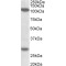 Ubinuclein 1 (UBN1) Antibody