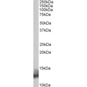 abx430944 (0.03 µg/ml) staining of Human Heart lysate (35 µg protein in RIPA buffer). Detected by chemiluminescence.