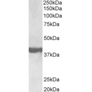 Biotinylated abx430948 (0.3 µg/ml) staining of Human Frontal Cortex lysate (35 µg protein in RIPA buffer). Primary incubation was 1 hour. Detected by chemiluminescence, using streptavidin-HRP and using NAP blocker as a substitute for skimmed milk.