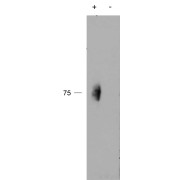 abx430952 (2 µg/ml) staining of IP from a lysate of Human Natural Killer cells with (+) or without (-) pervanadate treatment of the cells. Primary incubation was 1 hour. Detected by chemiluminescence.