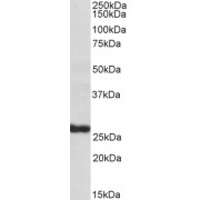 abx430963 (1 µg/ml) staining of Human Skin lysate (35 µg protein in RIPA buffer). Detected by chemiluminescence.