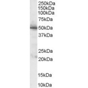 abx430987 (1 µg/ml) staining of Human Pancreas lysate (35 µg protein in RIPA buffer). Primary incubation was 1 hour. Detected by chemiluminescence.