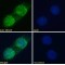 Helicase SRCAP (SRCAP) Antibody