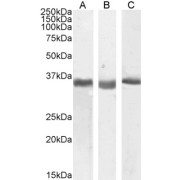 abx431000 (0.5 µg/ml) staining of Human (A), Mouse (B) and Rat (C) Kidney lysate (35 µg protein in RIPA buffer). Detected by chemiluminescence.