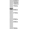 Methylmalonate-Semialdehyde Dehydrogenase [acylating], Mitochondrial (ALDH6A1) Antibody