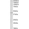 GRAM Domain-Containing Protein 2B (GRAMD3) Antibody