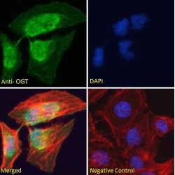 UDP-N-Acetylglucosamine--Peptide N-Acetylglucosaminyltransferase 110 kDa Subunit (OGT) Antibody