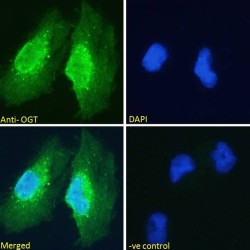 UDP-N-Acetylglucosamine--Peptide N-Acetylglucosaminyltransferase 110 kDa Subunit (OGT) Antibody