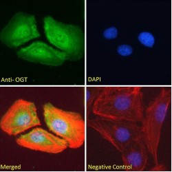 UDP-N-Acetylglucosamine--Peptide N-Acetylglucosaminyltransferase 110 kDa Subunit (OGT) Antibody