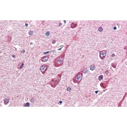 UDP-N-Acetylglucosamine--Peptide N-Acetylglucosaminyltransferase 110 kDa Subunit (OGT) Antibody